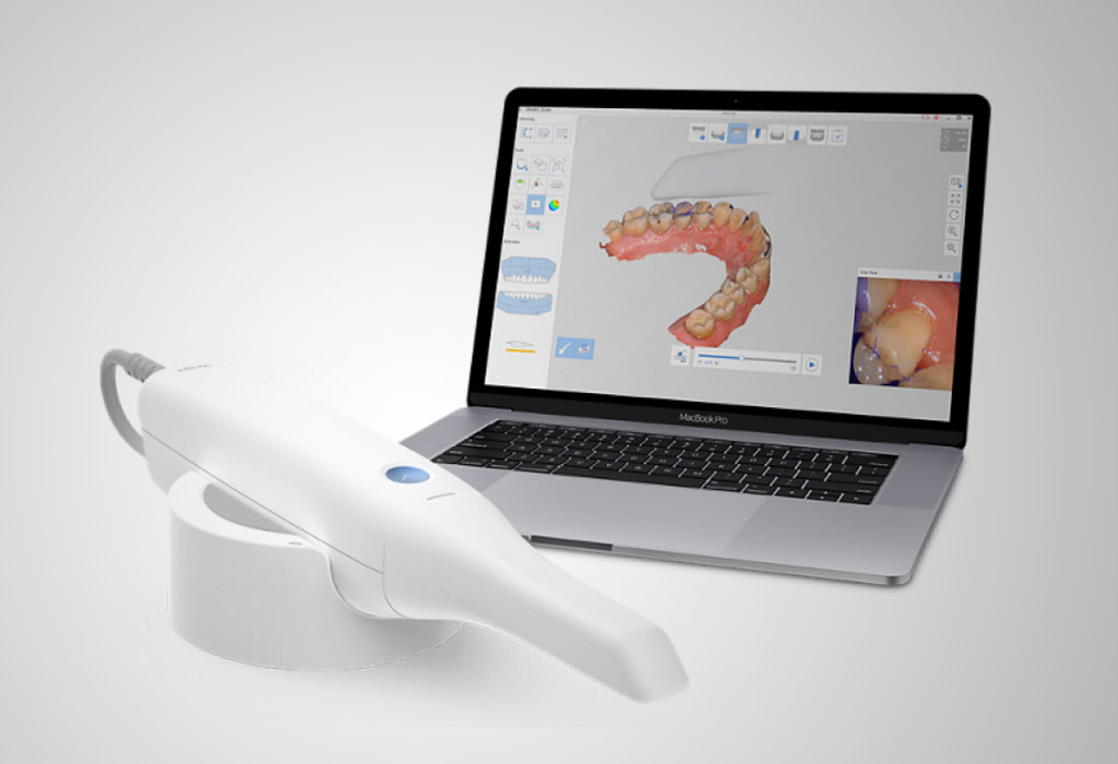 escáner intraoral 3D en Berga